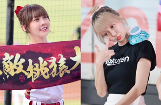 啦啦隊女神罹病「膝蓋鈣化」 驚曝：復健沒用恐動刀