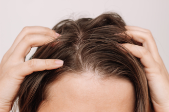 頭皮老出油吃4類食物有解 營養師曝3食材護髮超強