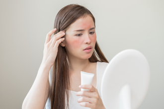 玫瑰斑不只皮肤问题！恐合併偏头痛、忧郁症 医警示及早治疗