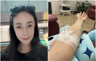 才罹患直腸癌4期！57歲資深女星宣布「動手術」