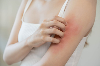 皮肤痒不只血糖高 医示警恐是癌 变1色也要注意