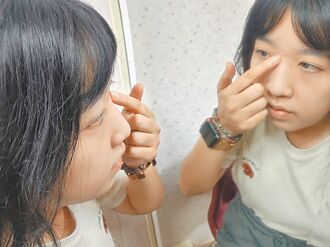 三角區痘痘別亂擠 當心細菌入侵大腦