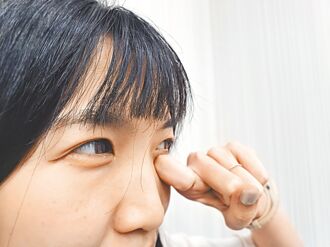 過敏性結膜炎紅腫癢 冷敷減緩不適