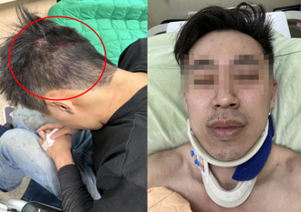 8＋9住宿不付錢還誣陷鑽石失竊！ 老闆慘遭圍毆住院「上網控訴」