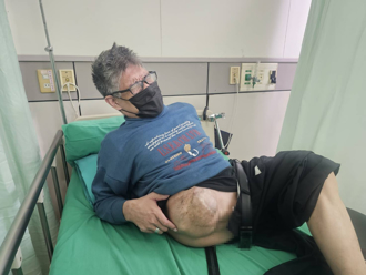 獨家》分離45年痛一輩子！連體嬰忠義病痛纏身惹鼻酸