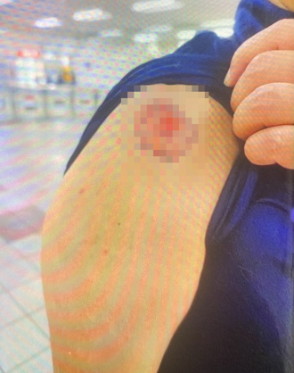 北捷車廂內爆發肢體衝突 男子咬傷乘客手臂遭法辦