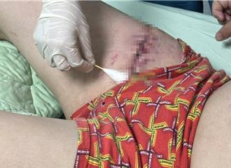 國道驚傳隨機砍人！仁德服務區休息遇襲  四肢遭砍肌腱斷裂