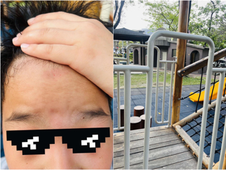 嘉市公園之都淪口號？維護經費遭疑不足 兒童設施破損危及安全