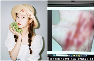 金賽綸「音檔持有者」頸部遭刺9刀！2兇嫌下手極狠、傷勢照曝光