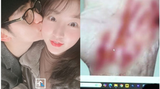 李鎮浩再救金秀賢！ 提3點秒反擊金賽綸：盜圖＋AI假音檔