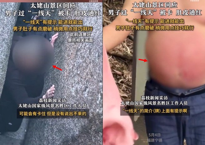 大肚男進一線天險卡,最後磨紅肚皮才終於脫困。(翻攝微博)