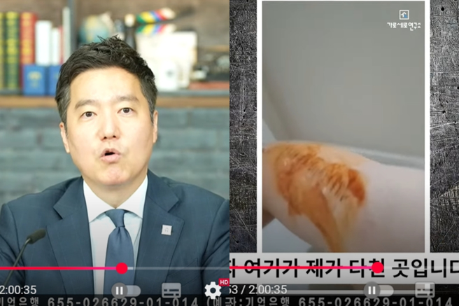 金賽綸生前錄音檔證人拍攝傷勢影片自清。(圖／가로세로연구소YT)