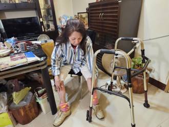 獨家》72歲歌后腰椎手術害左腳癱！人生跌谷底哽咽：我要站起來