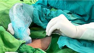 病患免於反覆打針之苦 台東馬偕引進PICC靜脈導管