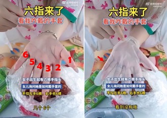 小女孩问「六指妈」怎么戴手套？ 陆网影片爆火引热议