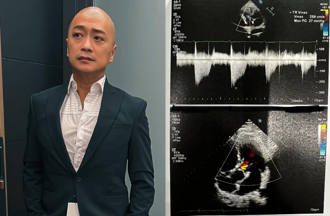 男星「心臟瓣膜少1片」仍服役2年！昔為挺兄弟遭關禁閉