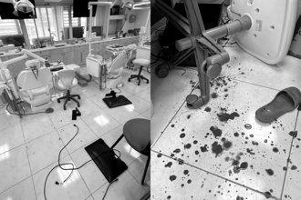 不滿洗牙太痛！台北男爆揍女牙醫嗆「不會輕點喔」診所濺滿血