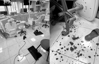 女牙醫疑遭設局洗牙痛毆！驚喊「怕黑道小弟來」 恐3000萬債務惹禍