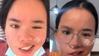 25歲女吹電扇睡覺「醒來臉癱了」 醫曝1族群風險飆3倍