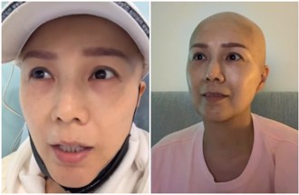 50歲女星癌症復發變四期！「三星期化療一次」 最新病況曝