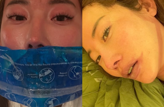 眭澔平險沒命！同團女神身體也出狀況「潰爛流血」驚悚過程曝