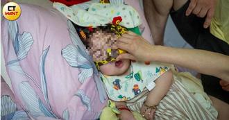 2月大女嬰手術成腦麻　檢方竟罵家長「我都沒怪妳早產」