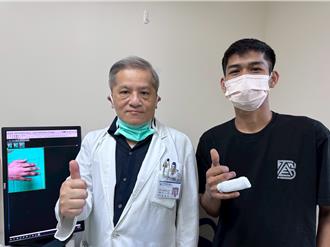 23歲移工遭機台捲斷指 醫師用1招神手接回獲新生