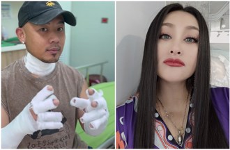 紀曉君擺攤氣爆！丈夫「二度燒傷送醫」影片曝最新近況