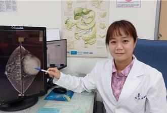 乳頭出血可能是警訊！45歲婦竟罹良性乳管內乳突瘤