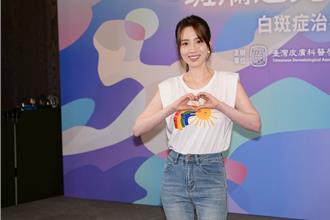 愛雅自爆「床上躲尪求歡」！裝睡硬被搖醒加班：很怕