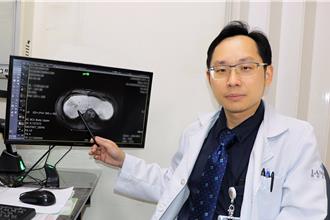 肝癌免疫標靶聯手出擊 醫曝關鍵：晚期也可能完全消失