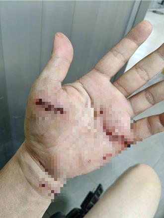 高雄左营獒犬「半月内咬伤2人」　动保处说话了