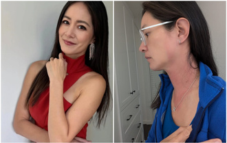 Janet突高烧40.1℃「脸颈红肿」！ 医验不出病因：检查正常