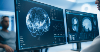 大腦26歲開始老化 4隱形殺手害早衰 醫曝解方