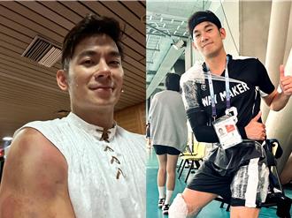 獨家》亮哲參加世壯運竟撕裂傷！「沒看過這樣」連女兒都心疼