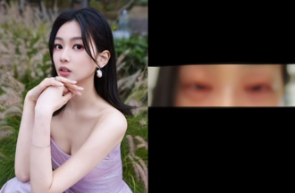 27歲香港小姐嚴重食物過敏 雙眼腫脹「面目全非」