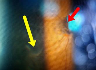 更年期婦擅自加倍服賀爾蒙藥物 釀眼內大出血險失明