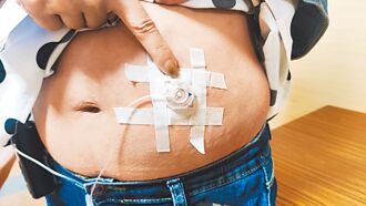 手指嘴唇偏黑 小心肺动脉高压找上门