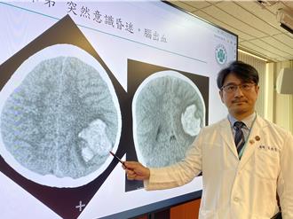 脑血管畸形4岁童突昏迷 创新脑内手术「精准拆弹」助重生