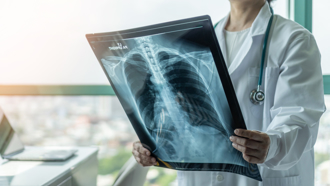 狂吸二手菸 爸爸每天在家抽 害11岁儿罹肺癌