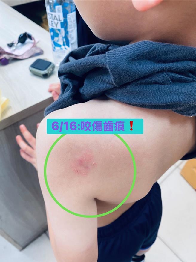 桃園市桃園區某國小有家長投訴，自己低年級小孩3月被同班A學生攻擊，反映後，該生家長稱只是在玩，拒絕溝通。16日還被咬傷，家長只好報警處理。桃園市教育局表示，學校接獲通報後立即進班釐清案情，並完成校安通報，將邀集雙方家長及教育局代表，共同研商雙方學生未來學習安排與配套措施。（桃園市議員黃瓊慧提供）