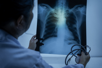 肺癌連21年登奪命癌王 醫：台人1常見習慣 一級致癌物秒飆百倍