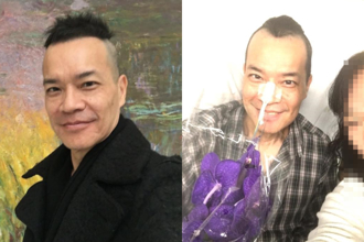 《射鵰》男星罹雙癌「切舌保命」！謝分開30年前妻無私照顧