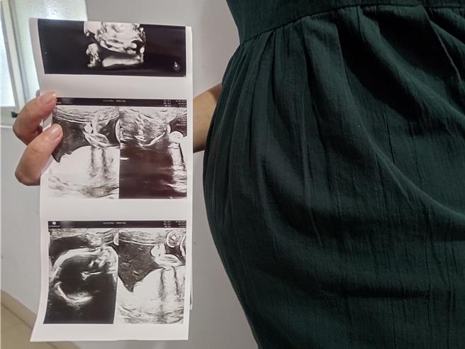 流行病学研究发现，怀孕早期暴露于Hydroxyprogesterone caproate成分药品，可能增加男性后代罹患癌症风险。（示意图／王家瑜摄）