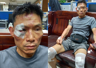 错认通缉犯！三重警打人获缓刑3年 惩戒判决降2级改叙