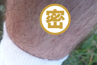 游日要当心！连兽医都中招 「蜱虫咬」病毒感染已3死