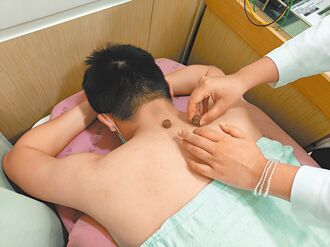 三伏貼冬病夏治 救過敏性鼻炎