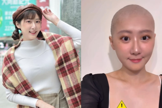 国光女神罹恶性卵巢癌 医示警：2常见妇科疾病患者风险高