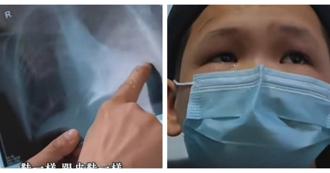 男童提不動書包竟是罕病作祟！醫驚見心臟變形如「鞋子」　