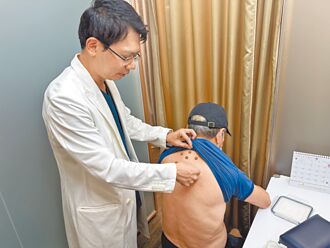 疫後免疫負債效應 夏季三伏貼 學生族群大增